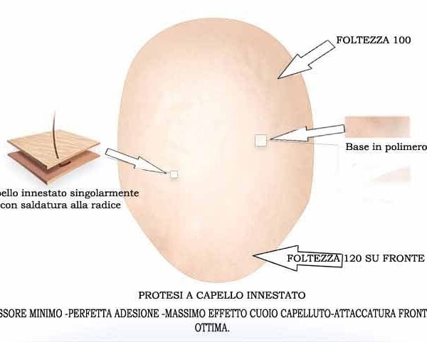 Impianto Capillare innestato Micro Derma XL