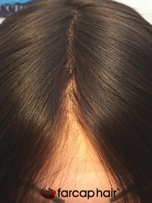 parrucca alopecia totale farcaphair