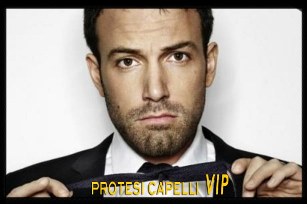 protesi capelli vip